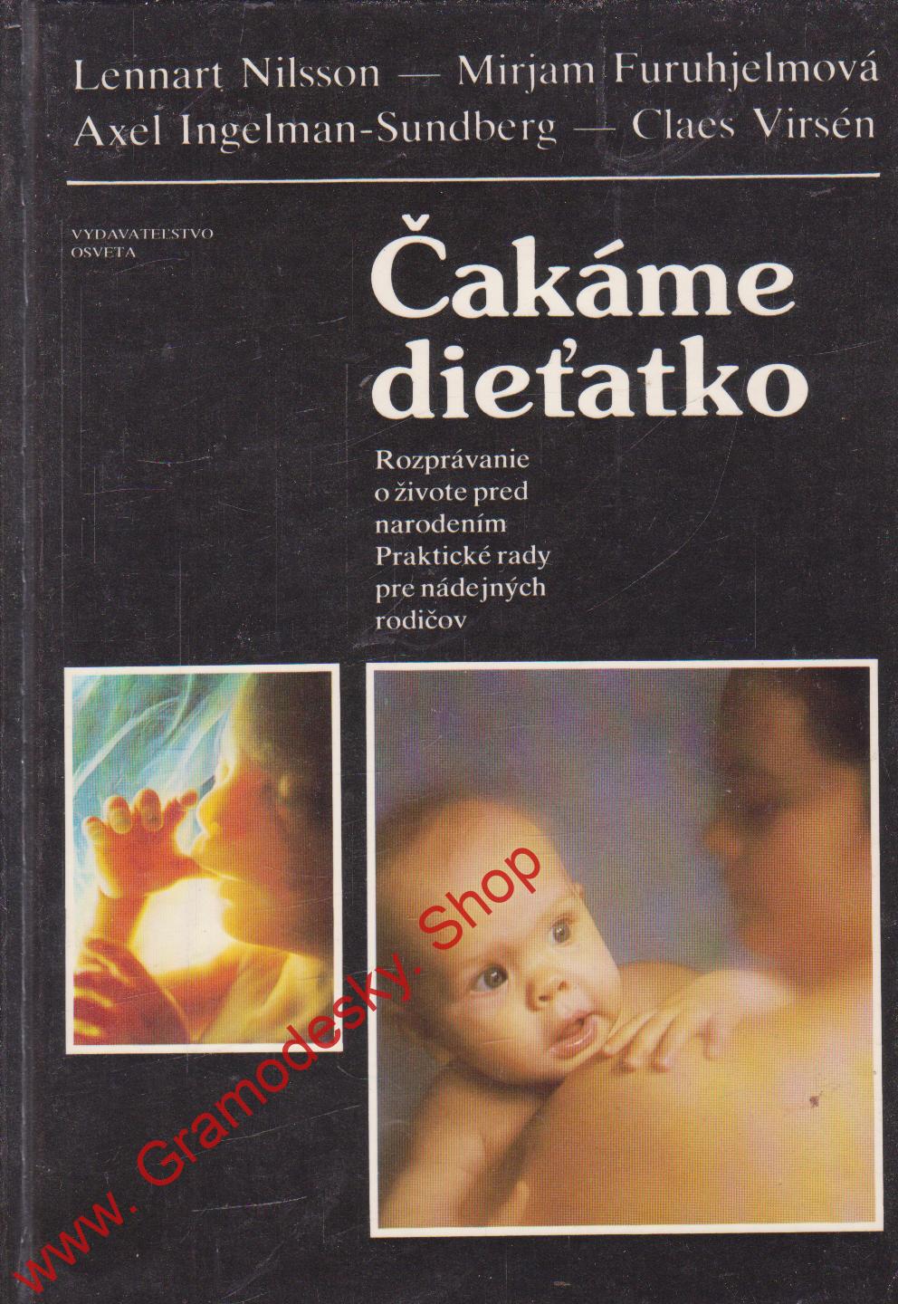 Čakáme dieťatko / Nilsson, Furuhjelmová, 1987